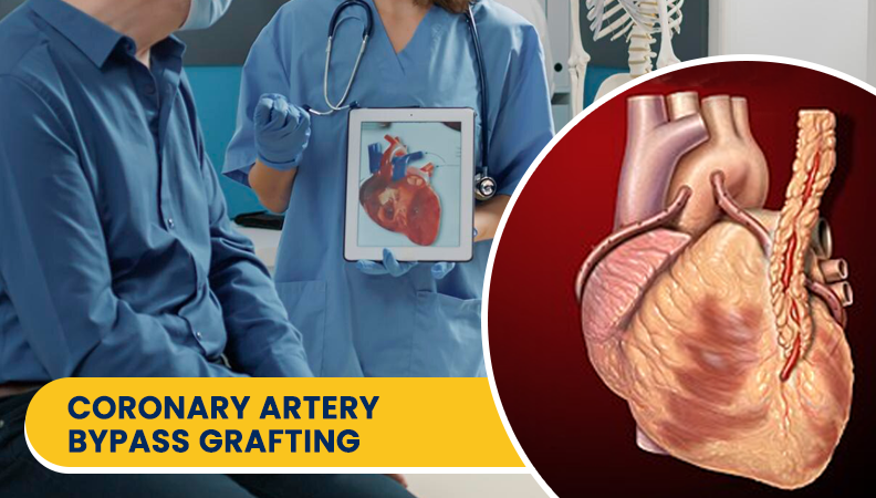 Coronary Artery Bypass Grafting (CABG) in Kolkata by Dr. Arup Kumar Ghosh