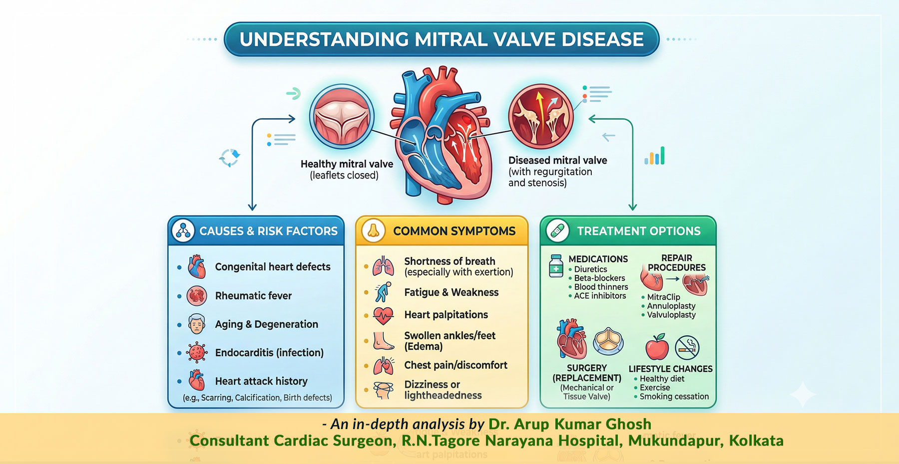 An essential guide to “Mitral Valve Disease: Causes, Symptoms & Treatment Options”  from Dr. Arup Kumar Ghosh, Renowned Cardiac Surgeon in Narayana Hospital, Kolkata